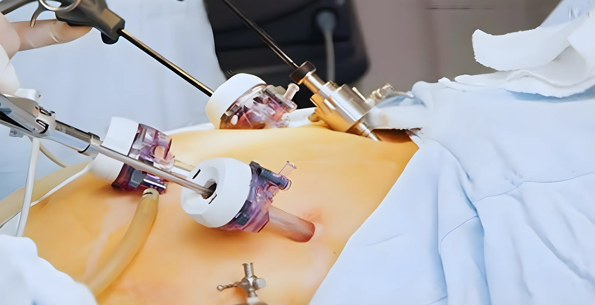 Dr. MD. Sabir Pasha - Laparoscopic Hysterectomy Specialist